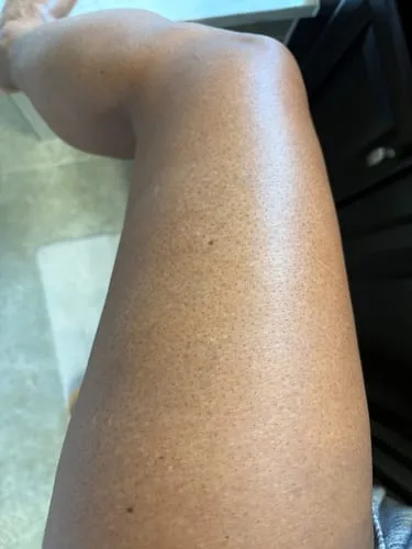 Customer photo review of Nirast Silk Body Oil