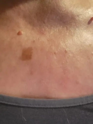 Customer photo review of Nirast Silk Body Oil